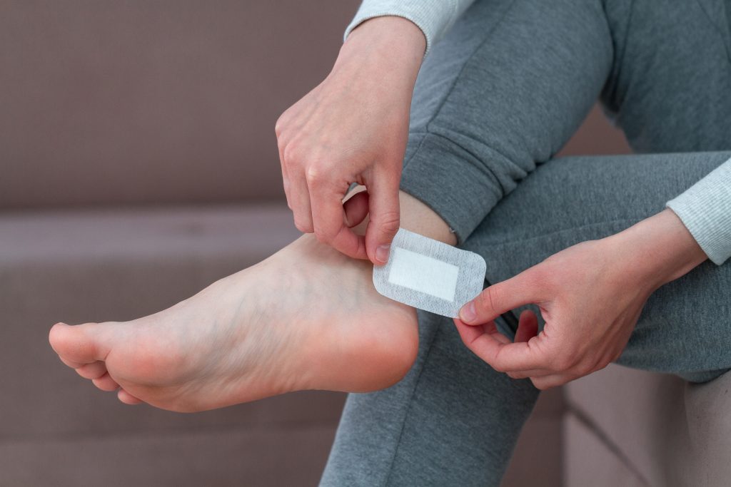 using-bactericidal-medical-adhesive-plaster-at-home-during-wearing-new-shoe-foot-skin-care-and-prevention-of-corns-and-calluses-1024x683